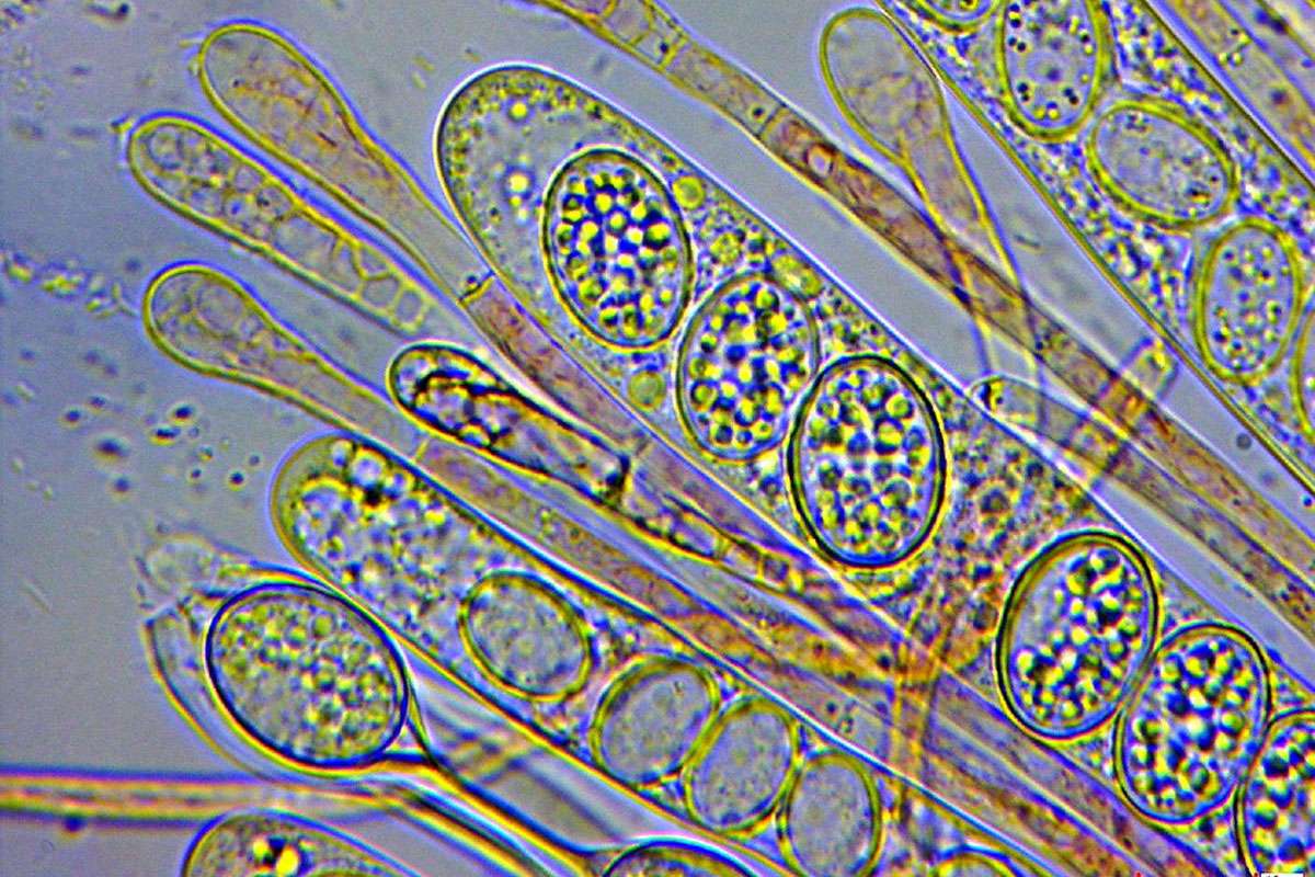 Asci mit Sporen und Paraphysen, Bewimperter Schildborstling  (Scutellinia crin, (c) Chris Engelhardt/NABU-naturgucker.de